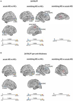 Altered neural intrinsic oscillations in patients with multiple sclerosis: effects of cortical thickness